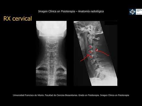 Simple Cervical X-ray Anatomy