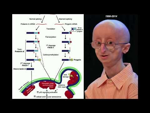 Progeria, Accelerated Aging | Biochemical Mechanism of Progeria