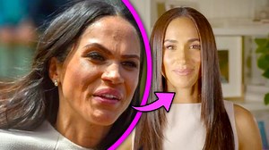 69K views · 152 reactions | Top 10 #BOTCHED #Celebrity #PlasticSurgeries Before & After That Are SHOCKING | Landonproduction | Facebook