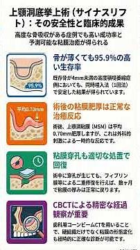 上顎洞挙上手術（Sinus Lift)～インプラント成功秘訣～♯ショート版