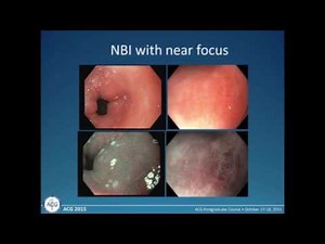 Advanced Endoscopic Techniques in Evaluation of the Esophagus: Where Do They Fit?