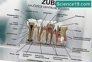 Kako napraviti model zuba za školski projekt 💫 Znanstveno-Popularni Multimedijalni Portal. 2025