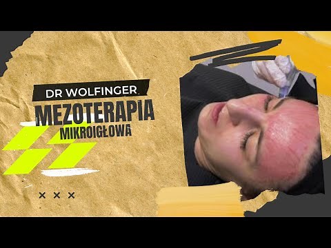 Dermapen - mezoterapia mikroigłowa