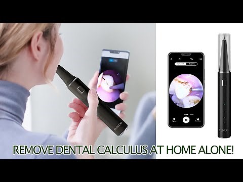Remove Dental Calculus At Home Alone! SUNUO T12 Pro Visual Ultrasonic Dental Scaler | KEPMOV