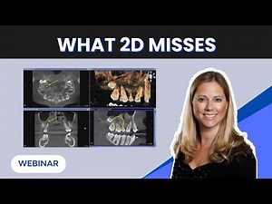 What You’re Missing Without CBCT