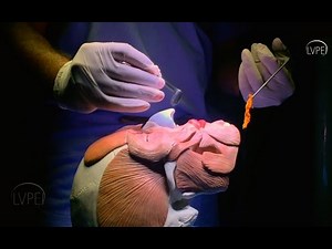 DCR Surgery: Correct Nasal Packing Technique