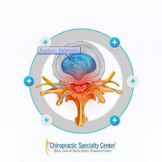 Prolapsed Disc: A Simple Explanation
