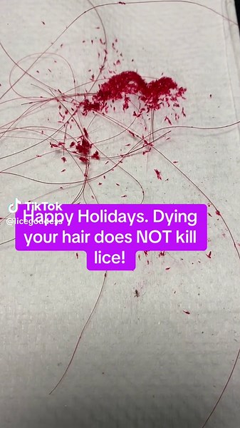 Myth Busted: Dying Hair Doesn't Kill Lice!