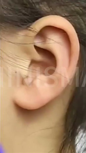 Safe & Simple Piercing with SEMINISMAR | At-Home Piercing Kit