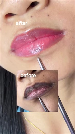 7 Days to Naturally Pink Lips with Seoul 1988 Serum