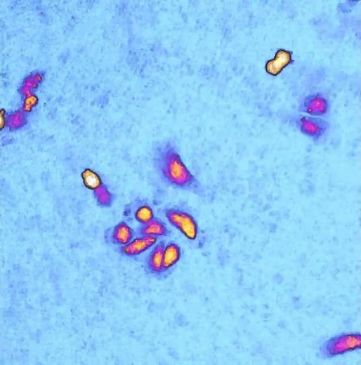 Live cell imaging of MDA-MB-231 cells | HoloMonitor®