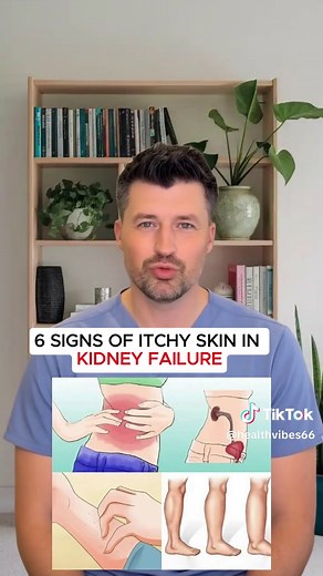 6 Signs of Itchy Skin in Kidney Failure