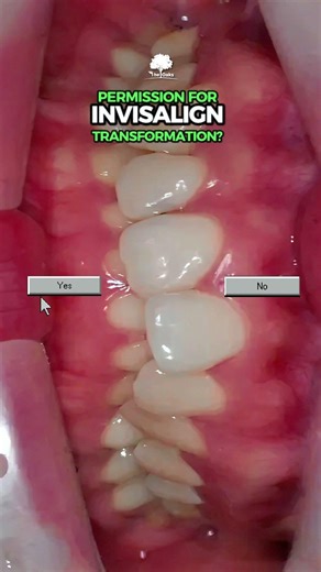 ✨ Transform Your Smile with Invisalign! ✨