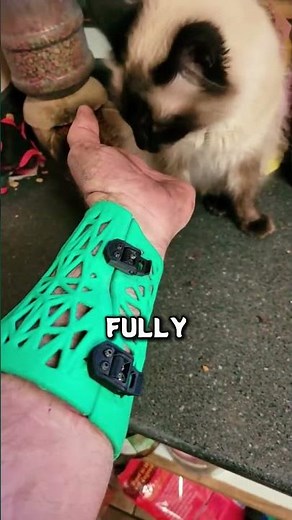 Engineer builds a fully mechanical prosthetic hand