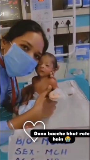 CUTE BABY IN NICU || NEONATAL
