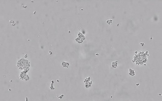 显微镜下的肝癌细胞HEP-G2细胞