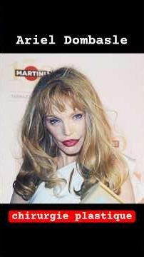 Ariel Dombasle plastic surgery