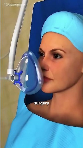 How Lapiplasty Surgery Is Performed (3D animation) #drone #theflash #space #automobile
