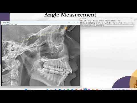 Image J: Angle Measurement
