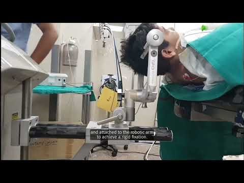 Robotic-Guided Radiofrequency Ablation for Hypothalamic Hamartoma Dr. Ramesh Doddamani, AIIMS Delhi