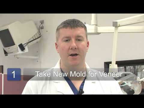 How to Repair a Porcelain Veneer on Teeth