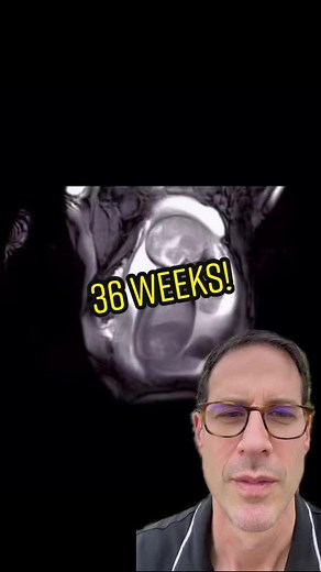 36 weeks last week of the preterm period‼️ #babiesoftiktok #doctorsoftiktok #pregnant #pregnancy #momsoftiktok #preemie Source: bestbeginnings