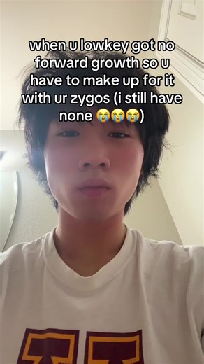 Understanding Facial Asymmetry and Zygomatic Growth