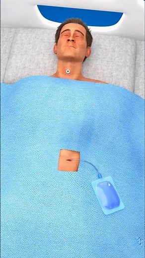 Permanent Mouth Closure: Feeding and Breathing Solutions