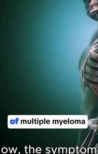 Multiple Myeloma: A Guide to Causes, Symptoms, and Treatments