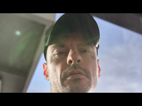 The DEVASTATING effects of methamphetamine use.