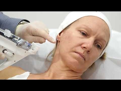 Teosyal Redensity I Beauty Booster Treatment