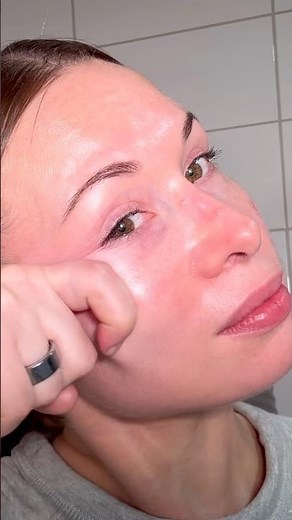 Puffy eyes lymphatic drainage technique