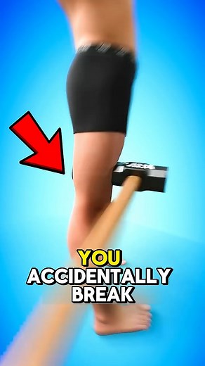 39K views · 1.4K reactions | Bone Poked Through Skin_ Do This! | Hidden Cell | Facebook