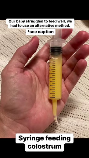 8.3K views · 27 reactions | Alternative feeding methods are sometimes...