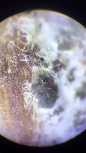 #microscope #magnification