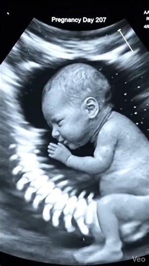 Pregnancy Week 30 (Day 207) | Ultrasound View 👶 #shorts #viralvideo