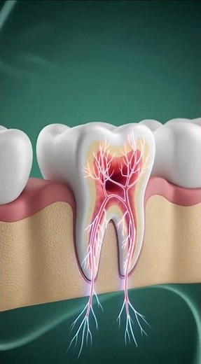 Diseases Caused by Cavities: 3D Medical Visualization #3danimation