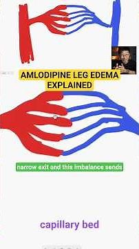 pharmacist explains amlodipine edema #heart #medicine #education