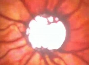 Эмбрион / Progeny (1998, США)