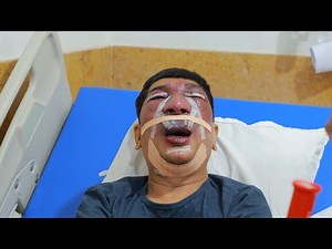 Bad Hemangioma on Face Removed | Full Surgery & Recovery