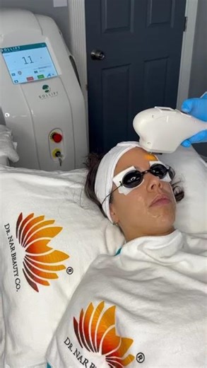 IPL Laser Facial rejuvenation