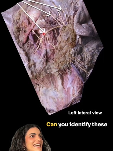 Identifying Medical Structure in Anatomy