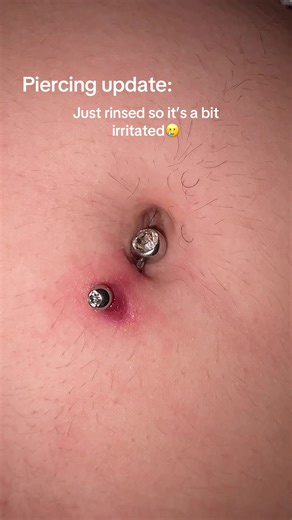 Belly Button Piercing Update: Progress and Feelings