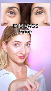 140K views · 1.8K reactions | Face massage for eye bags #eyebags #eyebagsremedy #undereyebags #undereyebagsbegone #undereyebagsanddarkcircles #facefitness #facefitnesschallenge #faceyogaexercises #facemassage | Elvin Dick | Facebook
