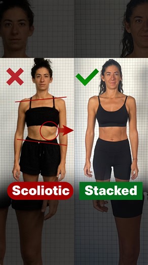 Functional Patterns on Instagram: "At Functional Patterns, we don’t guess—we measure, refine, and execute with precision. That’s how we get results that stick. Take Abigail, for example. In just 3 months and 12 sessions total, she’s transformed her body and her life. Her spine is straighter, her rib shift has dramatically decreased, and her body is decompressing to the point where she’s no longer coughing during sessions due to her compressed spine and ribcage. The changes aren’t just surface-le