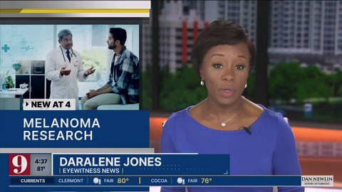 Research on better treatments for the deadliest melanoma continues in Central Florida
