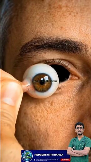 Yellow Eyes: A Serious Warning Sign You Must Not Ignore | #eyeinflammation #eyeinfection