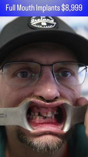 BionicSmile on TikTok