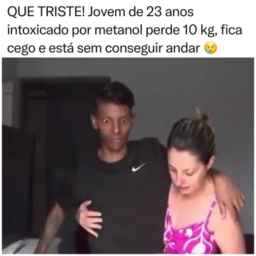 Central da Fama on Instagram: "Com dez quilos a menos, ainda debilitado fisicamente e completamente cego, Leonardo se recupera em casa após ficar 33 dias internado, depois de ingerir bebida alcoólica adulterada numa balada. O que ele não sabia que tinha sido intoxicado com metanol. No dia 26 de setembro, uma sexta feira, ele foi levado para a UPA. O prontuário mostra que os médicos suspeitaram de intoxicação por metanol porque Leonardo estava com a visão turva, ataxia, que é a dificulda