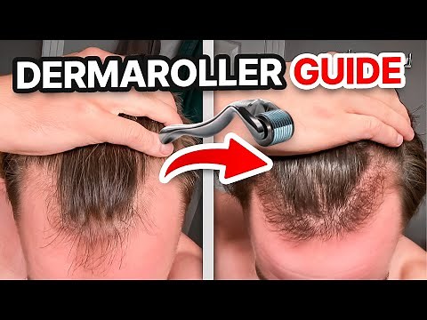 How To Use the Derma Roller for Hair Loss (Avoid These 3 Mistakes!)